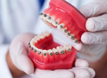 Ortodonti İçin En Uygun Zaman