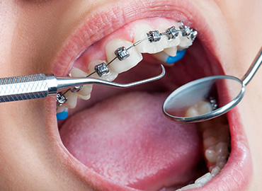 Ortodonti Nedir?